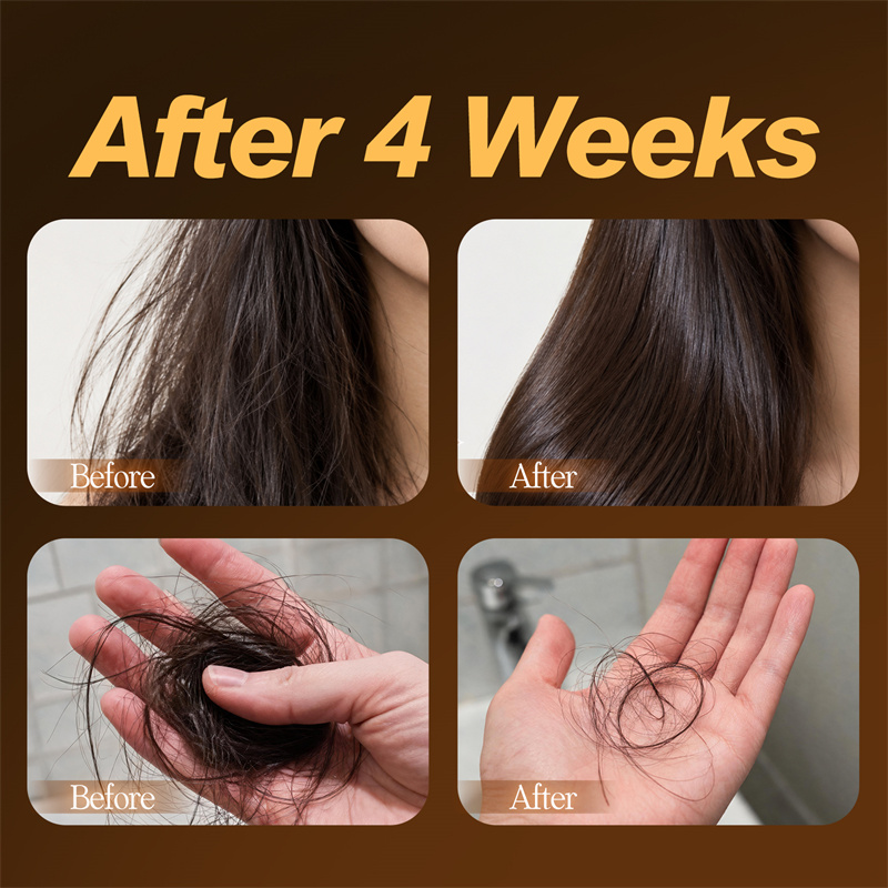 شامبو صلب أسود من سيفيتش 120 ج - مراجعة Hair Care Pantene وسعره
