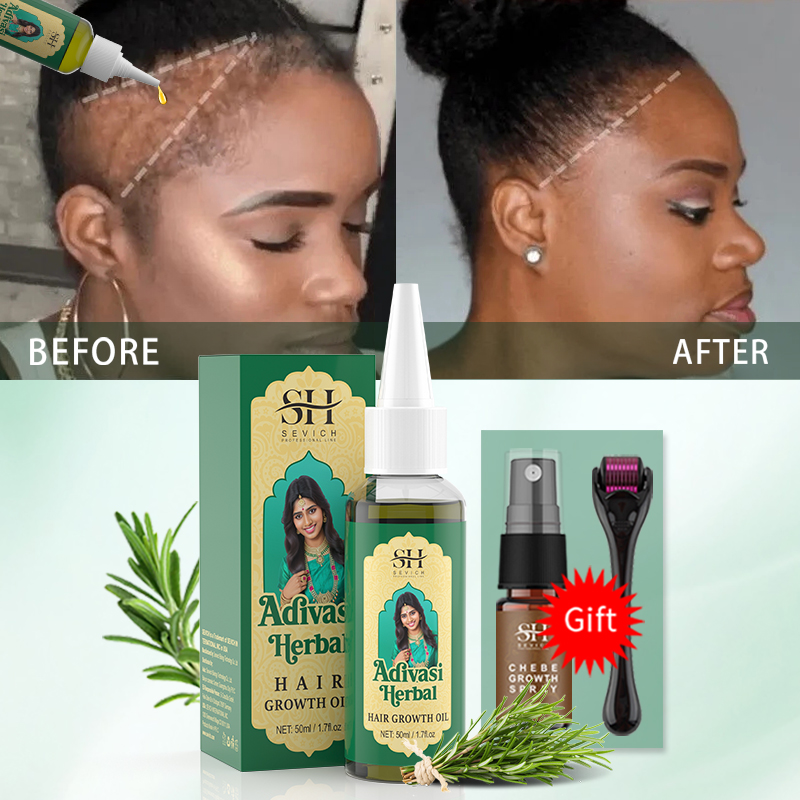 زيت نمو الشعر الأيورفيدي الهند - مراجعة Hair Care Oil Serum وسعره