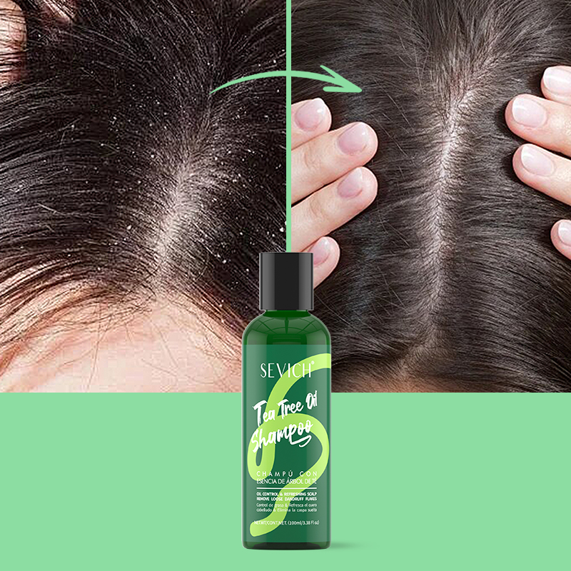 شجرة الشاي جوهر شامبو بلسم الش - مراجعة Hair Care Essence وسعره